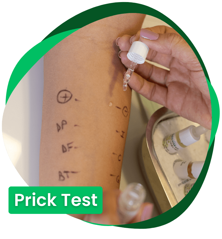 prick test